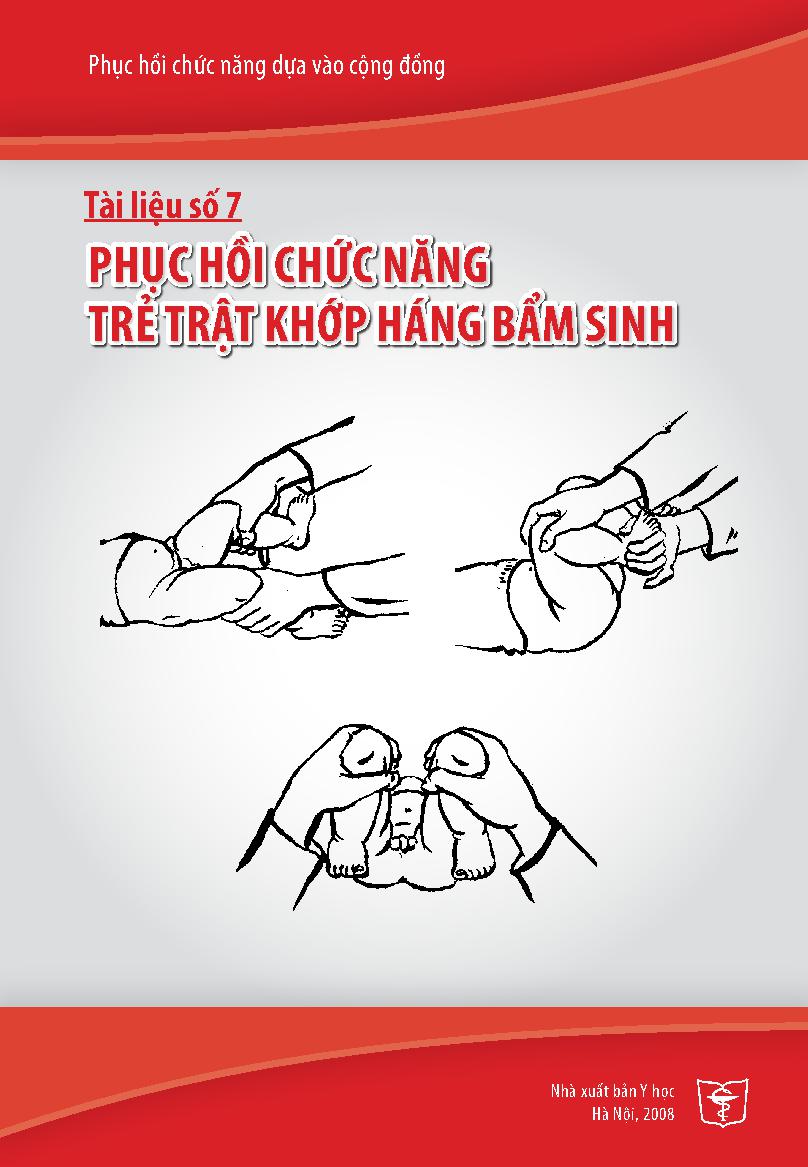 Phục hồi chức năng dựa vào cộng đồng.Tài liệu số 17,$pPhục hồi chức năng trẻ trật khớp háng bẩm sinh/ Nguyễn Thanh Bình... [Và những người khác biên soạn